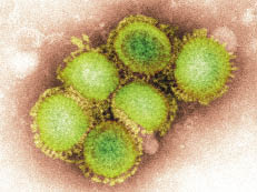 Микрофотография вируса пандемического гриппа А (H1N1), полученная при помощи сканирующего электронного микроскопа Микрофотография вируса пандемического гриппа А (H1N1), полученная при помощи сканирующего электронного микроскопа