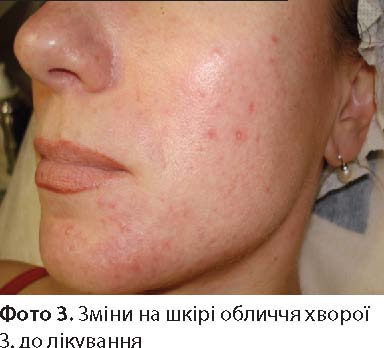 Фото 3 фото 3